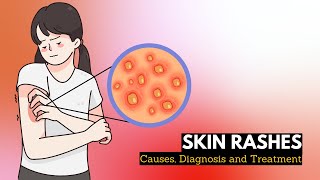 Skin Rash Causes Signs and Symptoms Diagnosis and Treatment [upl. by Ullman44]