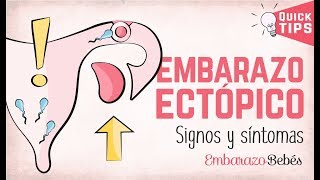 EMBARAZO ECTÓPICO 💔😭 Signos y síntomas [upl. by Ignazio]