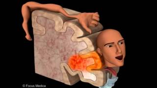 Primary Motor Cortex  Neuroanatomy [upl. by Oiznun]