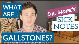 What are gallbladder stones [upl. by Nandor]