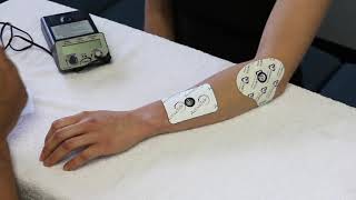 How to set up Iontophoresis [upl. by Naanac675]