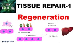 TISSUE REPAIR Part 1 Repair  Regeneration [upl. by Jacynth785]