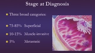 Bladder Cancer [upl. by Merrick561]