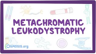 Metachromatic leukodystrophy  causes symptoms diagnosis treatment pathology [upl. by Lednek]