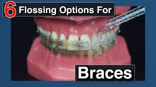 How to Floss with Braces [upl. by Atinele950]