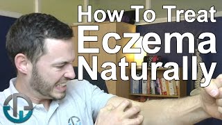 How To Treat Eczema Naturally [upl. by Laemaj]