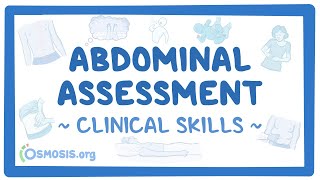 Abdominal Assessment Clinical Skills [upl. by Dola]