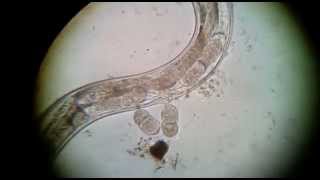 ENTEROBIUS VERMICULARIS gravid female laying eggslive video [upl. by Geri]