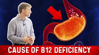 Vitamin B12 Deficiency The most common Cause – Dr Berg [upl. by Chaille844]