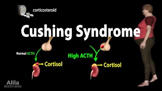 Cushing Syndrome Animation [upl. by Sams]