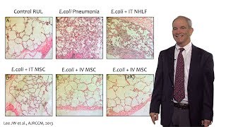 Challenges with implementing mesenchymal stem cells into practice [upl. by Umont]