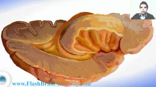 Brain Ventricles Anatomy And Insular Cortex [upl. by Quiteri]