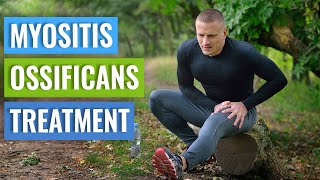 Myositis Ossificans Causes amp Treatment [upl. by Anirbys]