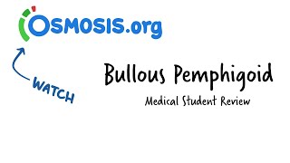 Bullous Pemphigoid Osmosis Study Video [upl. by Soinski131]