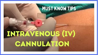 INTRAVENOUS IV CANNULATION in 5 mins How to insert [upl. by Lorac715]