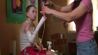 EJ had Epidermolysis Bullosa EB  quotThe Worst Disease Youve Never Heard Ofquot [upl. by Suzetta]