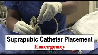 Oregon Urology Catheter Care Basics [upl. by Ahsilav]