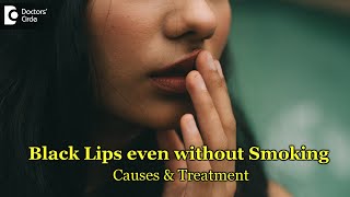 How to get rid of dark spots on lipsDr Rasya Dixit [upl. by Larrej]