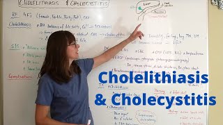 Cholelithiasis amp Cholecystitis [upl. by Sorips247]