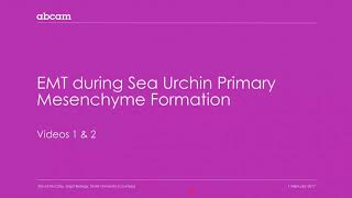 Cancer Epithelial mesenchymal transition EMT 111 [upl. by Arinay]